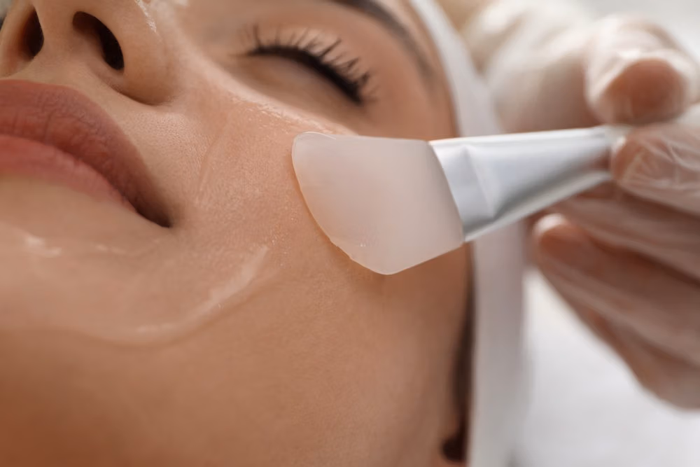 Chemical Skin Peel Treatment in New Jersey | Anara Medspa