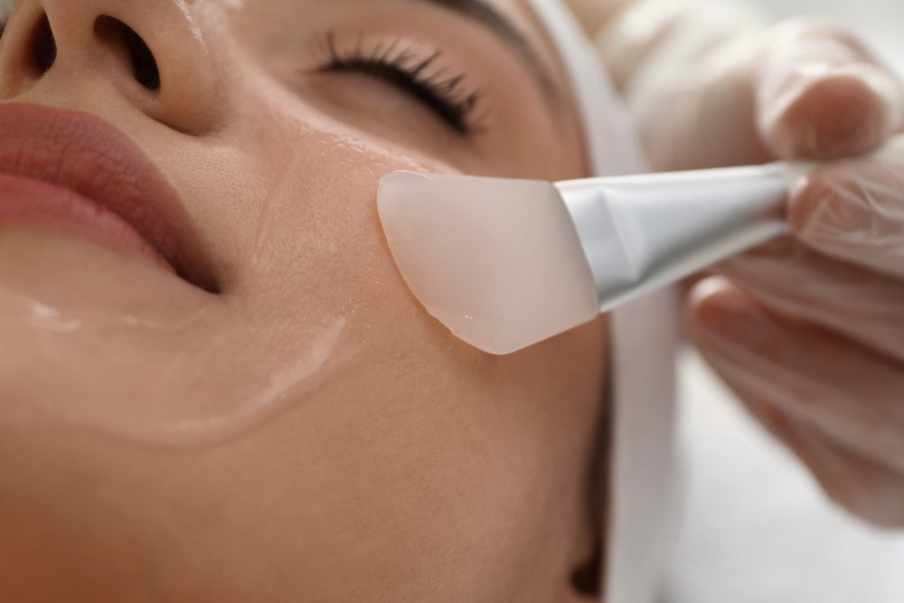 Chemical Skin Peel Treatment in New Jersey Chemical Skin Peel Treatment in New Jersey | Anara Medspa
