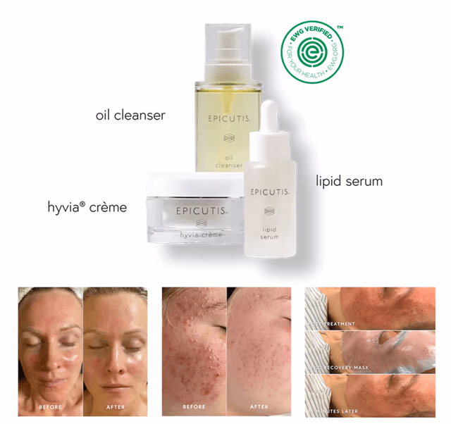 LUXURY SKINCARE SET- Epicutis