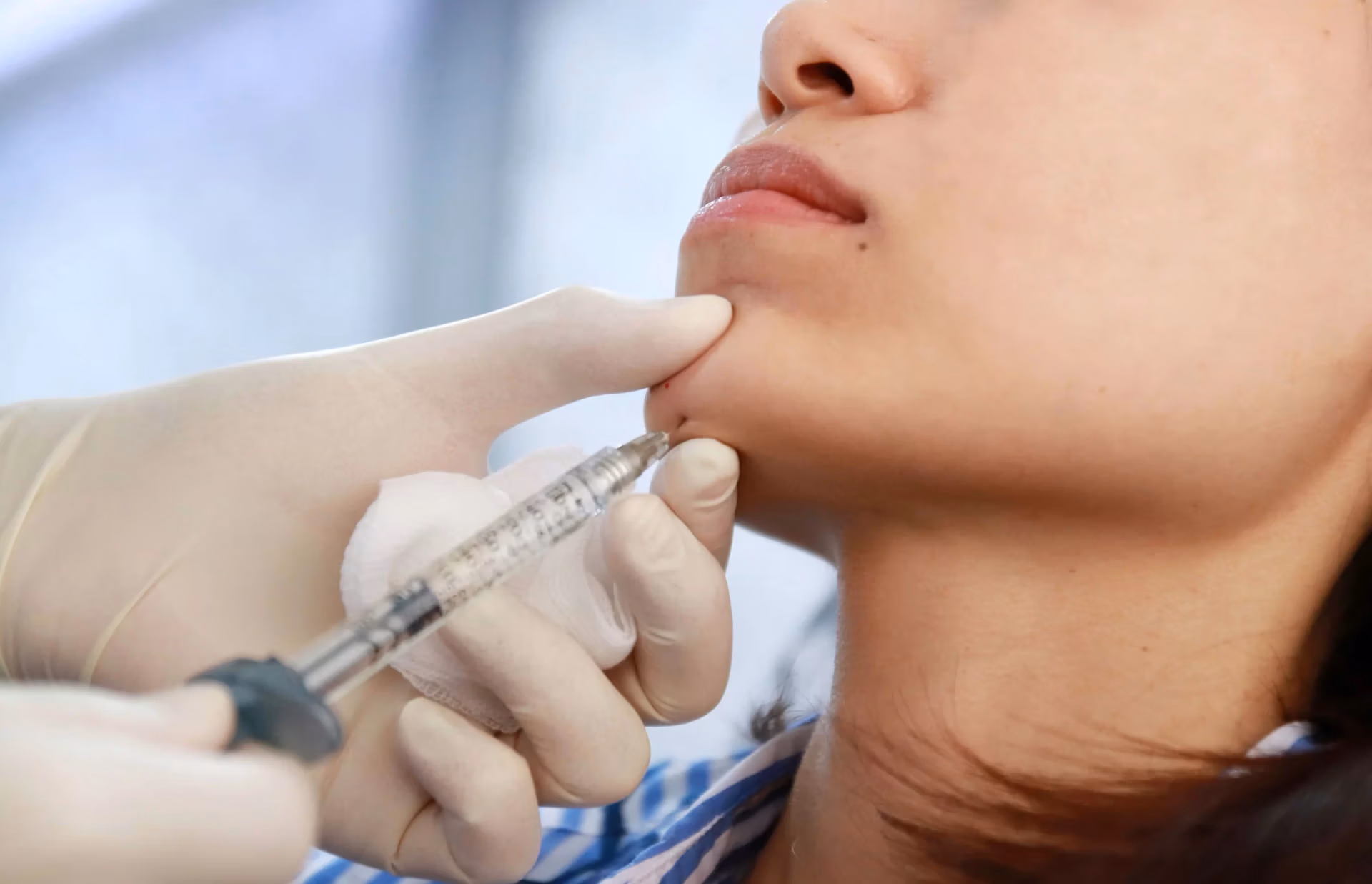 Chin augmentation in East Brunswick, New Jersey Chin Augmentation in East Brunswick, New Jersey