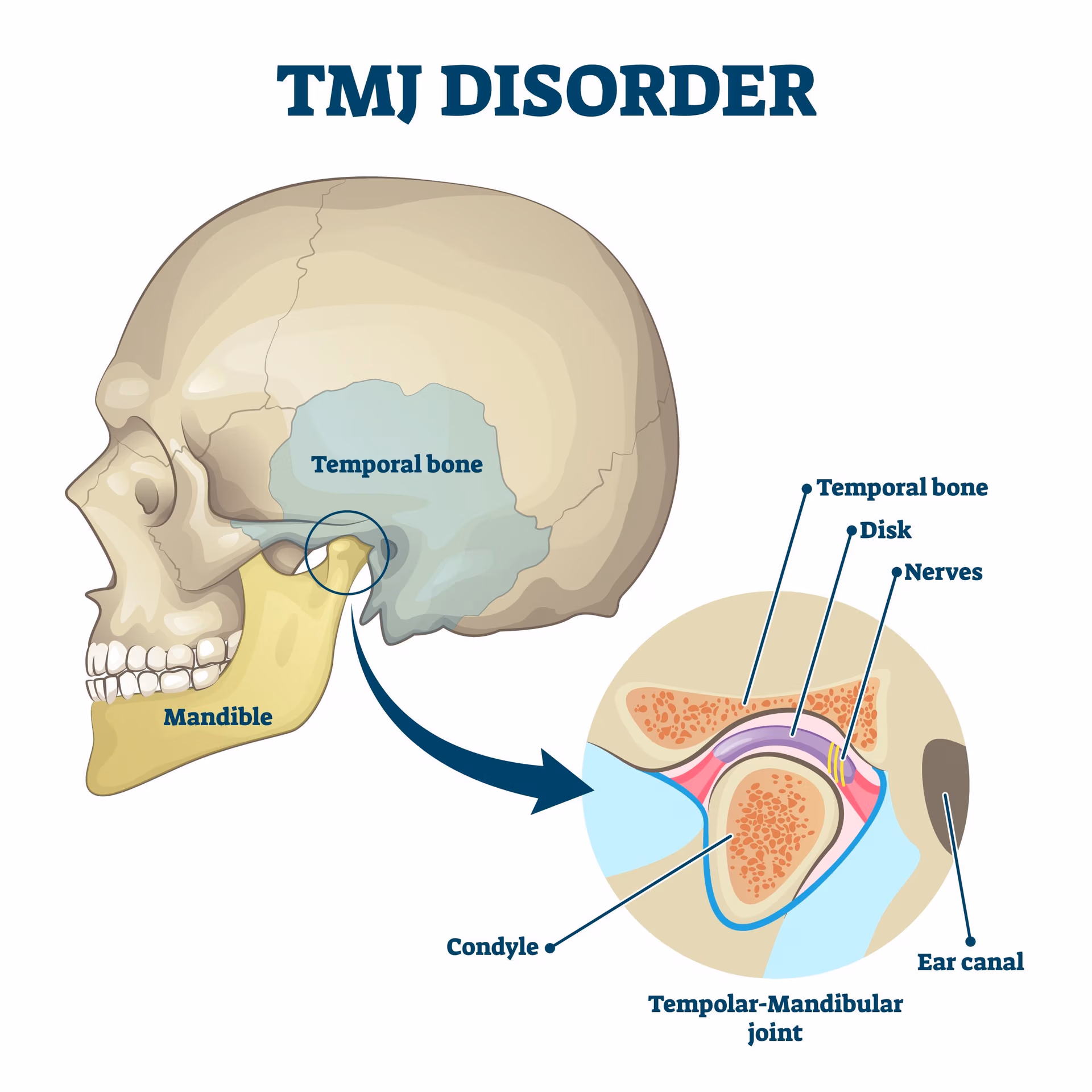 Botox for TMJ Pain in New Jersey
