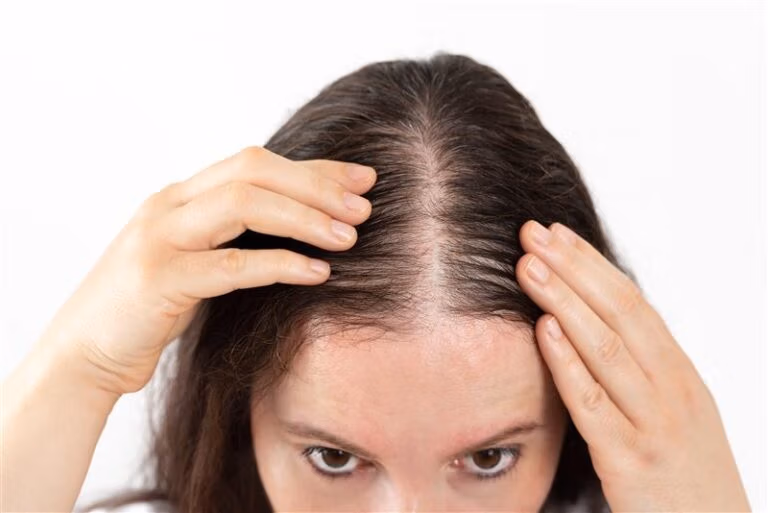 KeraLase Hair Restoration Before