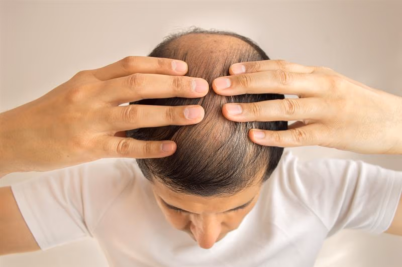 KeraLase Hair Restoration